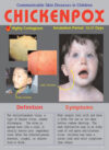 Communicable Skin Diseases: Chicken Pox, Poster