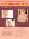 Communicable Skin Diseases: German Measle, Poster