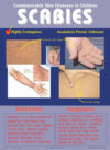 Communicable Skin Diseases: Scabies, Poster